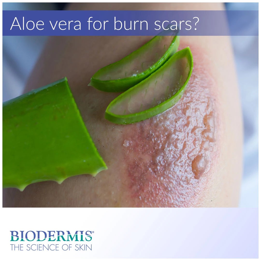 aloe vera scrub Rose & Aloe Face Scrub for Sensitive Skin