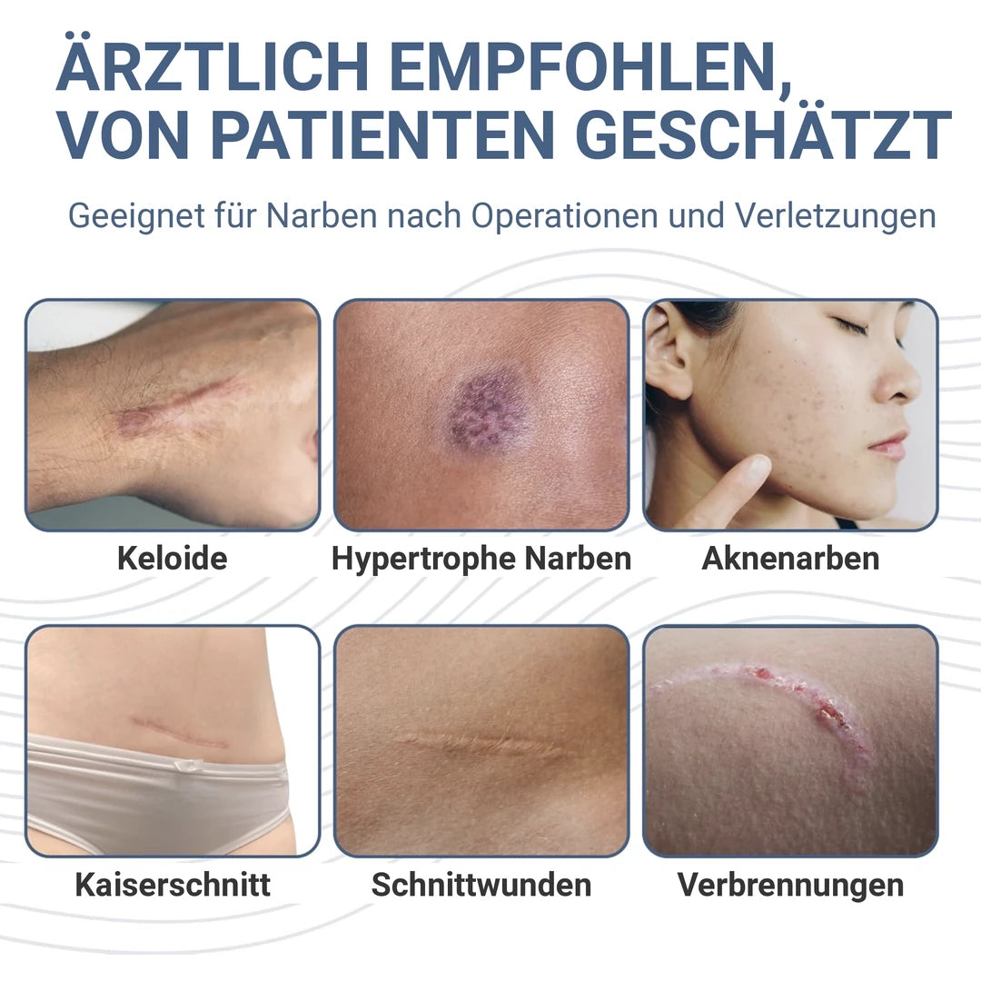 Sechs Narbenarten im Überblick: Keloide, hypertrophe Narben, Aknenarben, Kaiserschnitt, Schnittwunden, Verbrennungen