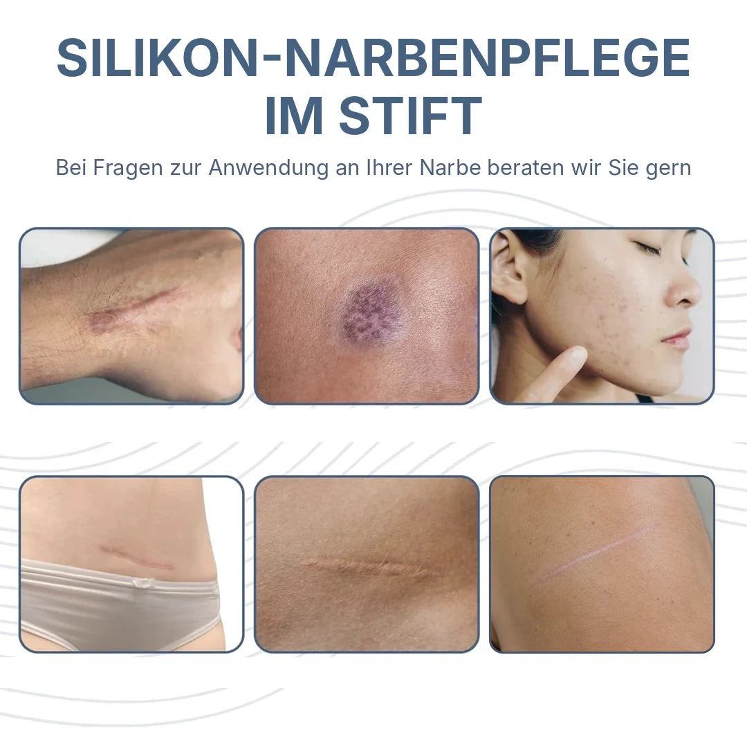 Sechs Beispielfotos von Narben an Unterarm, Haut, Gesicht, Bauch und Schulter mit Hinweis auf Beratung zur Anwendung von Pro-Sil