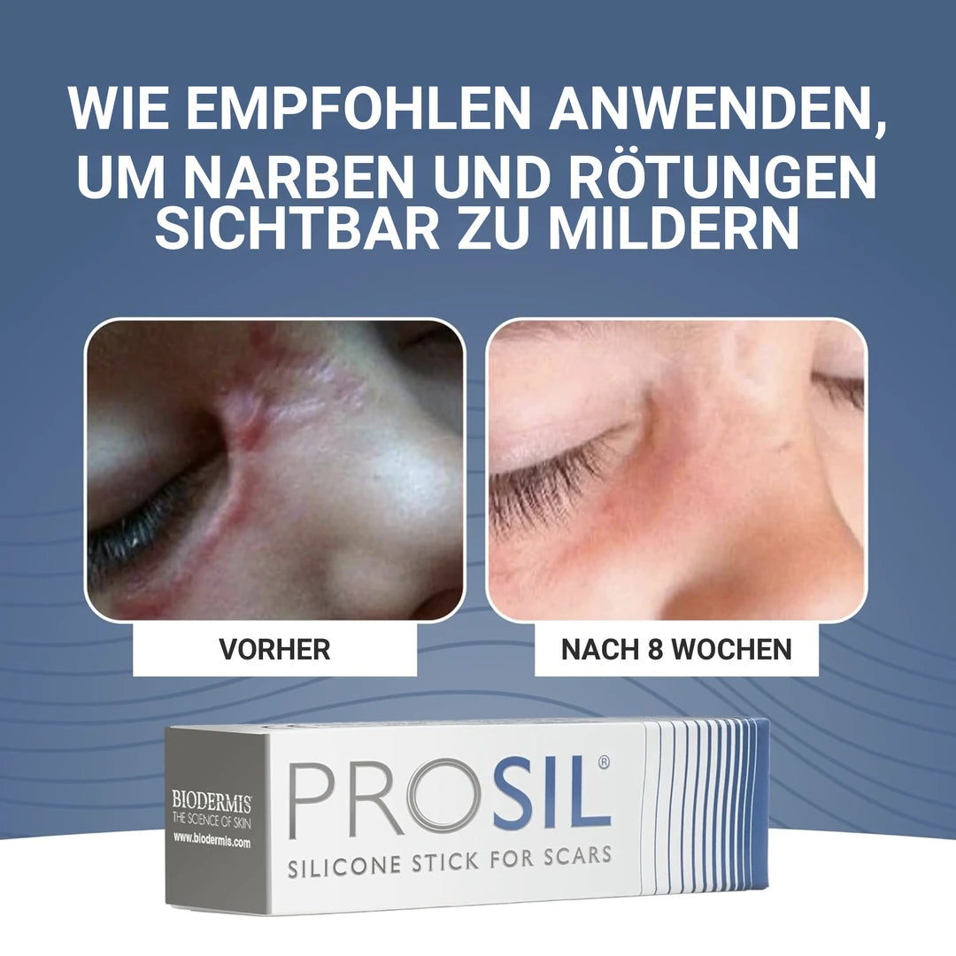 Vorher-Nachher-Vergleich einer Narbe am Auge nach acht Wochen Anwendung von Pro-Sil