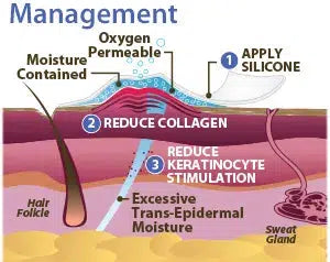 Management