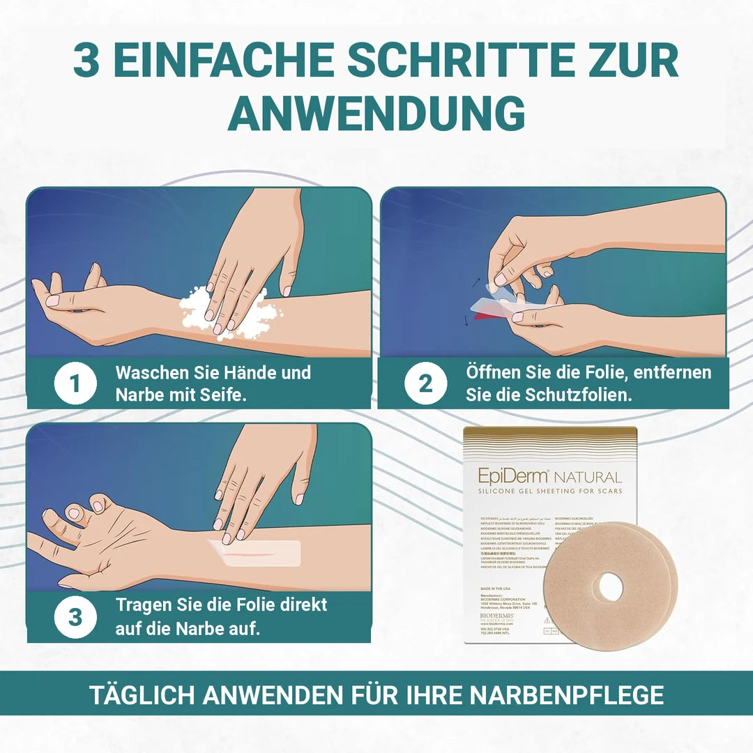 Narbenpflaster Areola 7,62cm (2 St.) Epiderm Natural | BIODERMIS | PZN 10173078