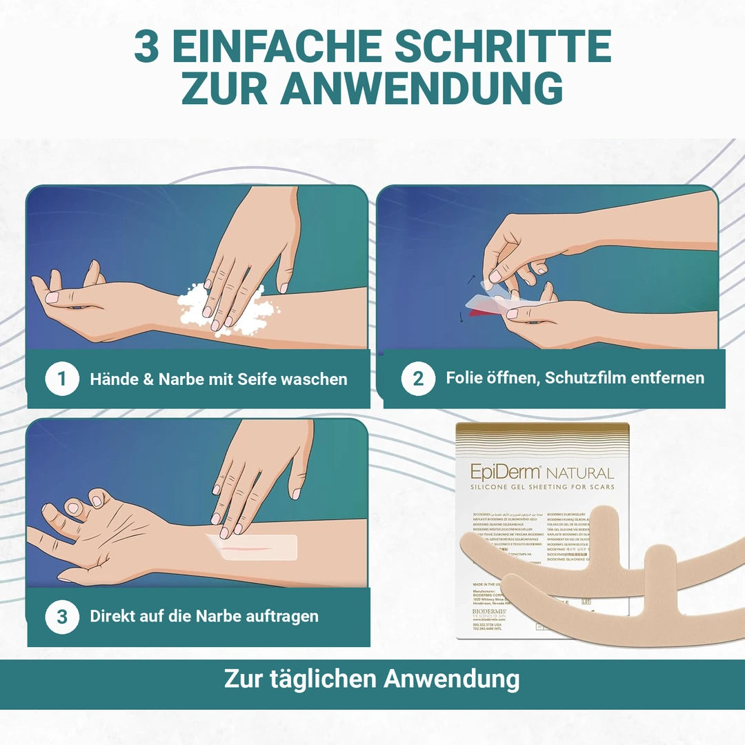 Ankerförmiges Silikon-Narbenpflaster für die Nachsorge nach Bruststraffung, Mammaplastik und Rekonstruktion, im Doppelpack
