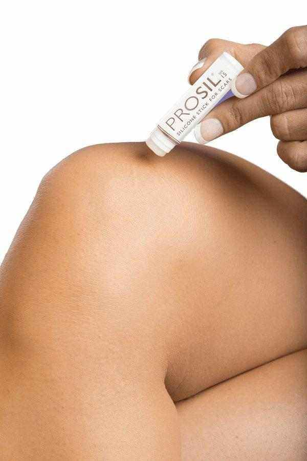 ProSil SPORT Silikon Narbenpflegestift 17 g LSF 15 | BIODERMIS | PZN 10308590 - Biodermis