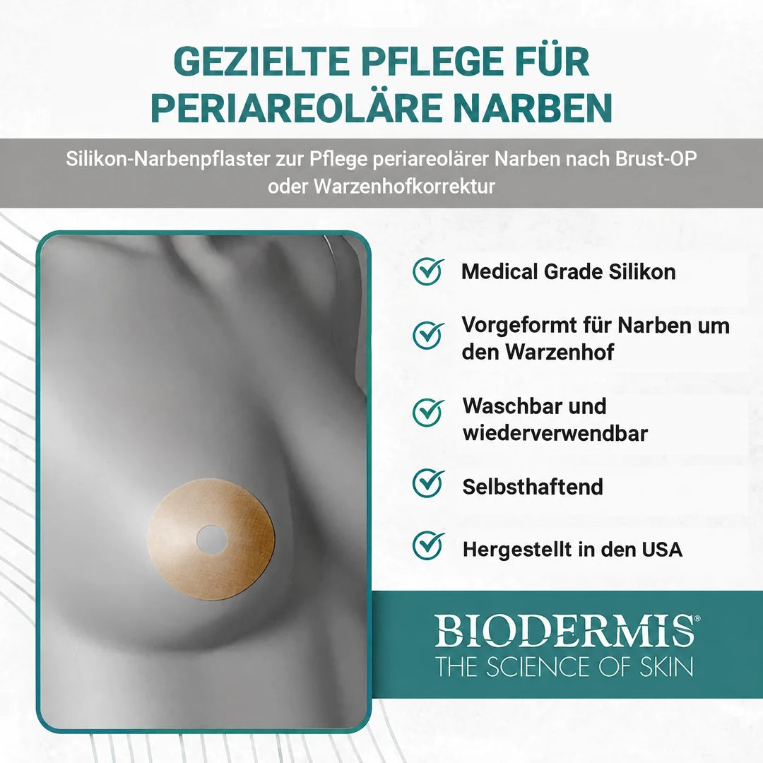 Epiderm Natural Areola-Narbenpflaster auf der Brust, Grafik zur Pflege periareolärer Narben