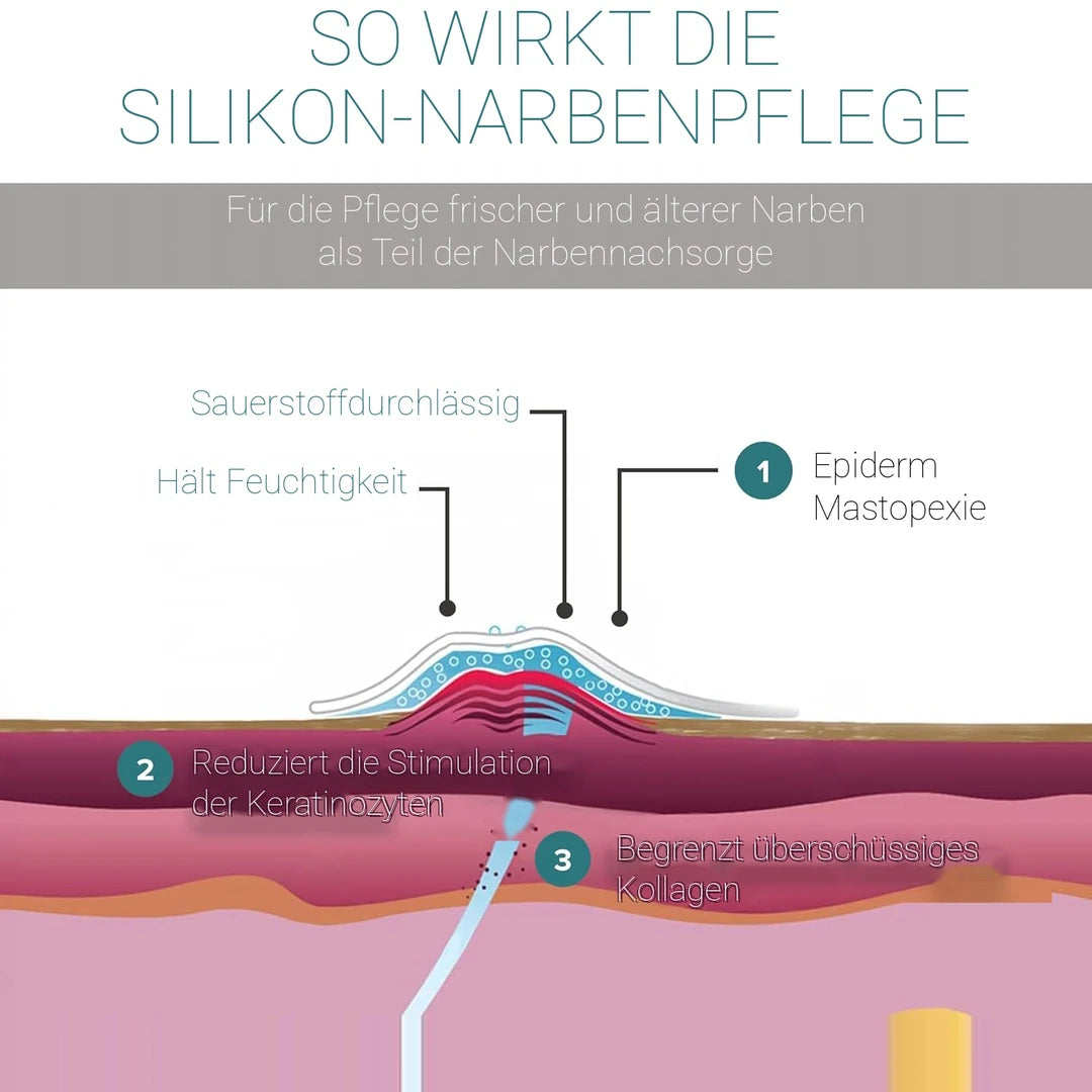 Schemazeichnung zur Wirkweise der Epiderm Silikonfolie auf einer Narbe: sauerstoffdurchlässig und feuchtigkeitshaltend