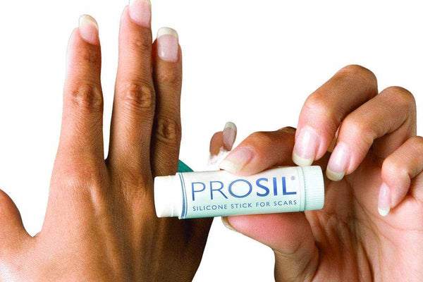 ProSil Silikon Narbenpflegestift 17g | BIODERMIS | PZN 06708444 - Biodermis-Shop