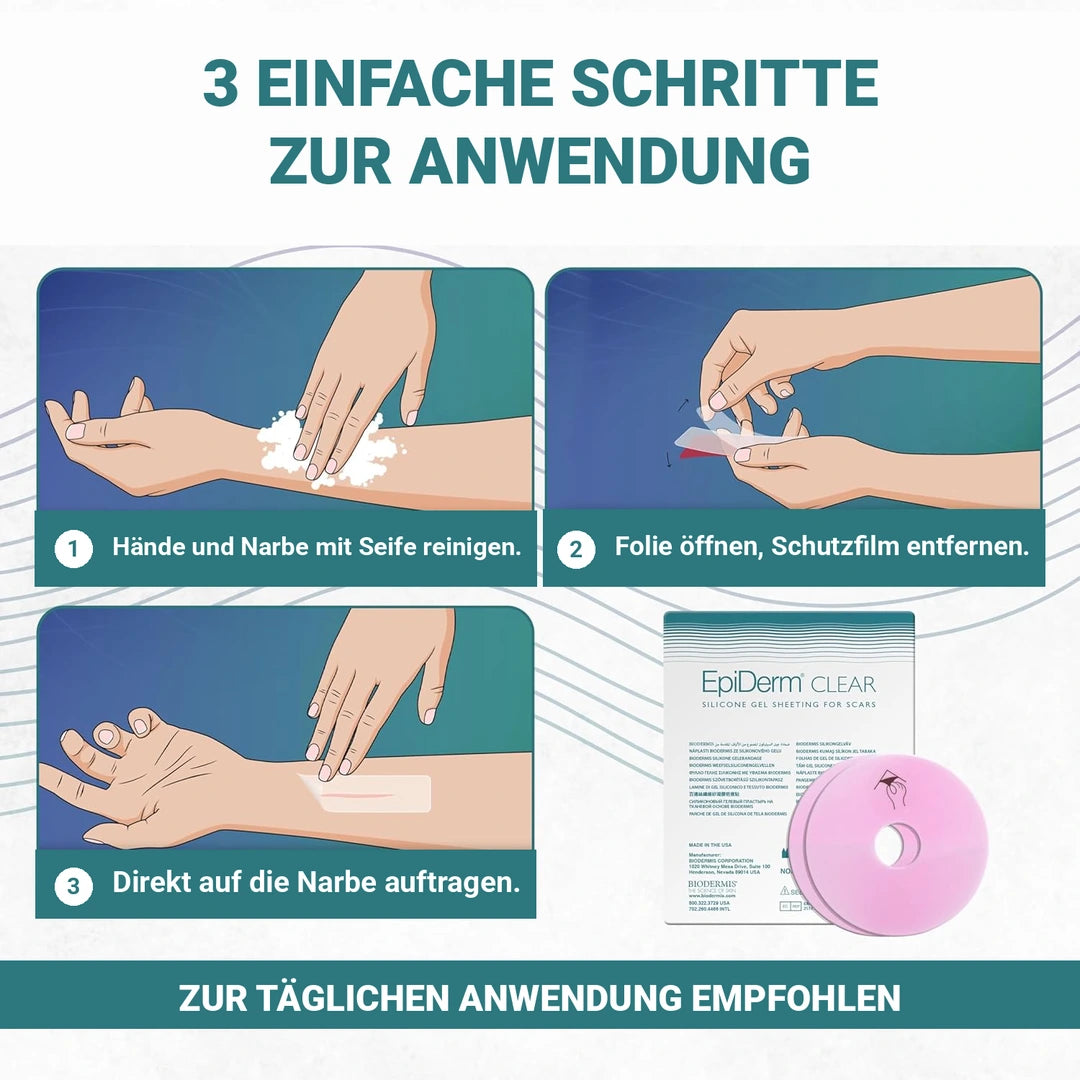 Narbenpflaster Areola 7,62 cm (2 St)Transparent Epiderm Clear | BIODERMIS | PZN 06708533